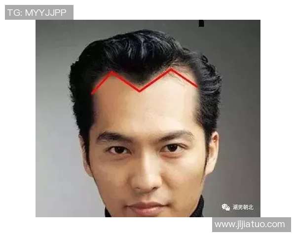 足球场上的M字发际线明星们如何逆袭成就辉煌人生